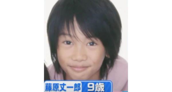 なにわ男子藤原丈一郎の口元と唇の傷が気になる！口唇裂との噂も？